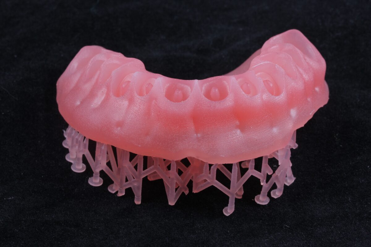 Modelo dental con soportes de impresión 3D