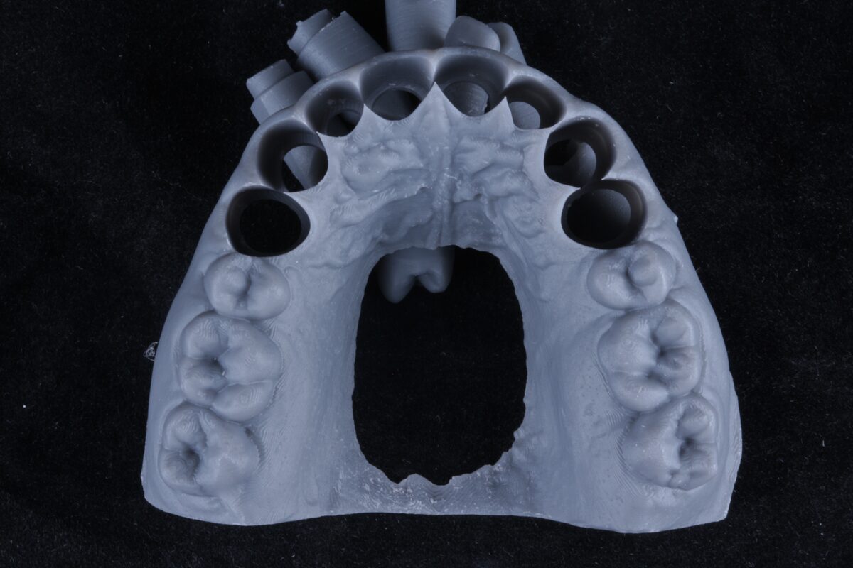 Modelo dental impreso en 3D